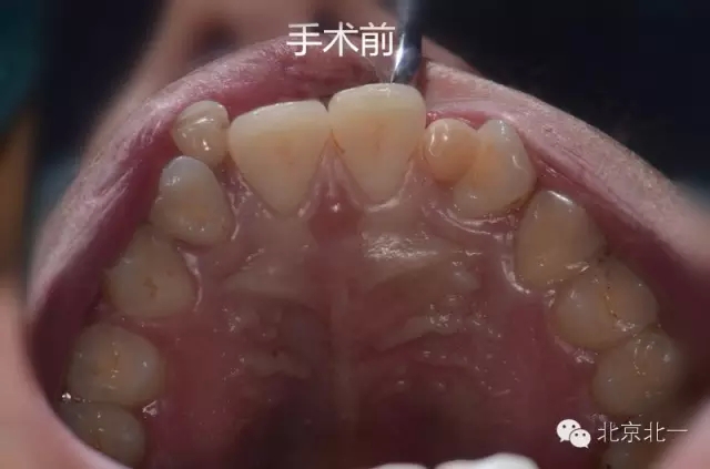 6.webp.jpg 6.webp.jpg