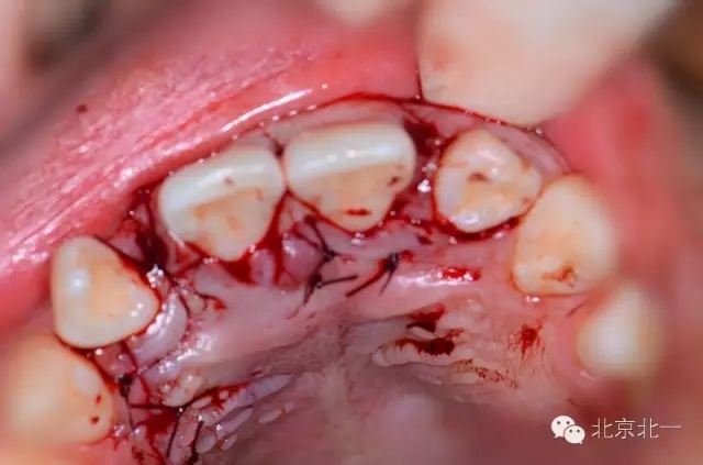 11.webp.jpg 11.webp.jpg