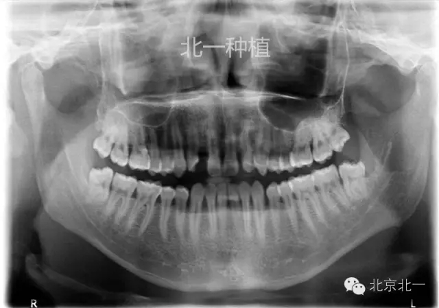 12.webp.jpg 12.webp.jpg