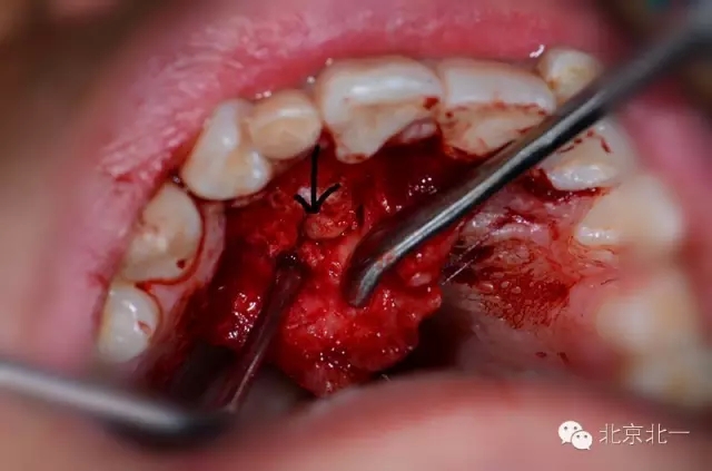 640.webp.jpg 640.webp.jpg