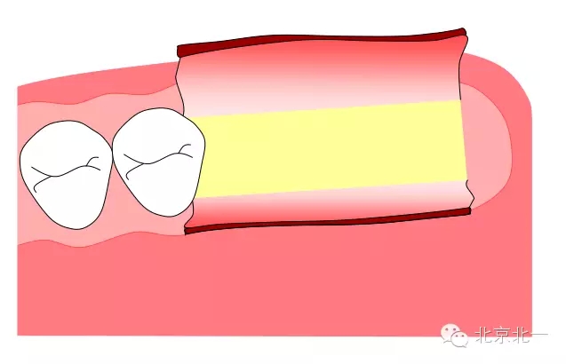 3.webp.jpg 3.webp.jpg