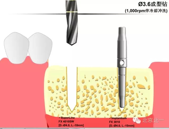 11.webp.jpg 11.webp.jpg