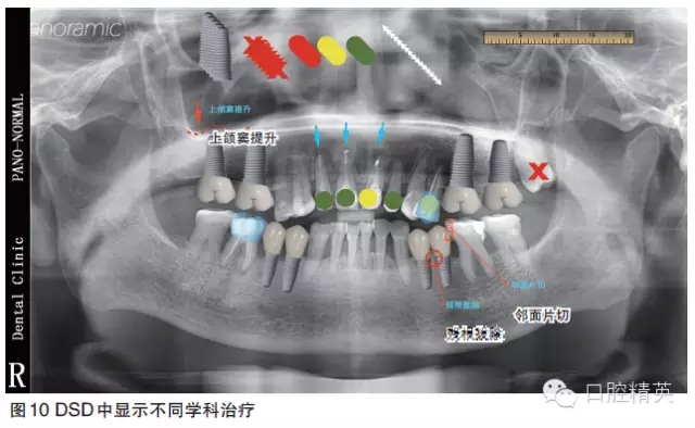6.webp.jpg 6.webp.jpg
