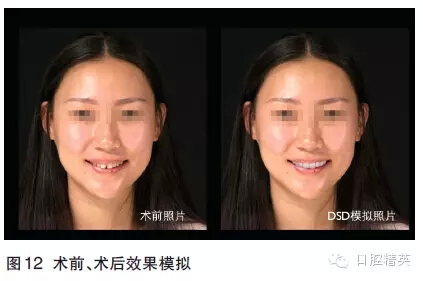 8.webp.jpg 8.webp.jpg