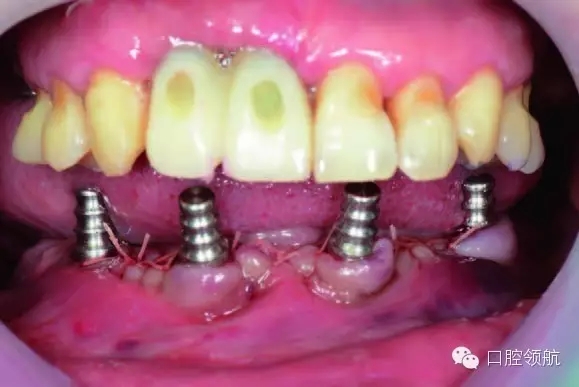 4.webp.jpg 4.webp.jpg