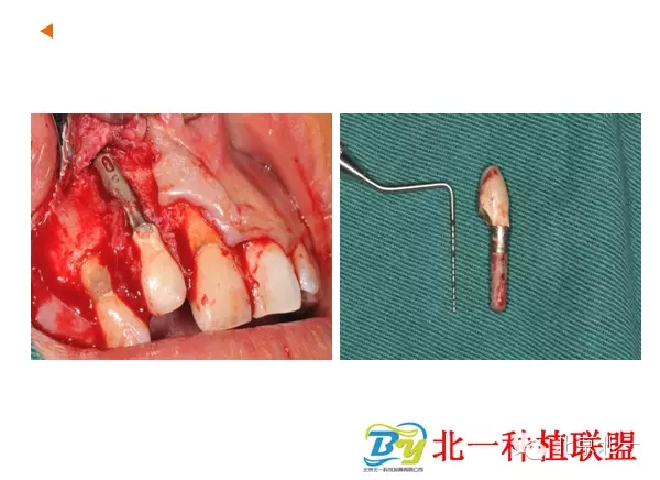 3.webp.jpg 3.webp.jpg