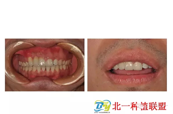 5.webp.jpg 5.webp.jpg