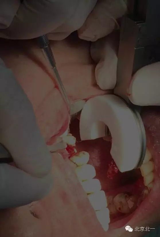 3.webp.jpg 3.webp.jpg