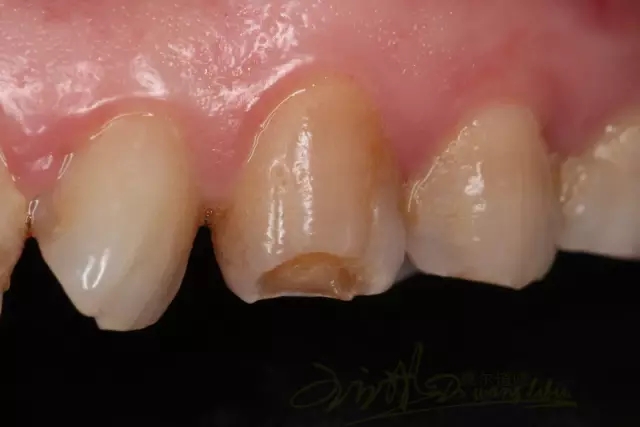 6.webp.jpg 6.webp.jpg