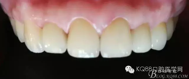 9.webp.jpg 9.webp.jpg