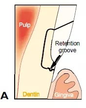 640.webp (3).jpg 640.webp (3).jpg