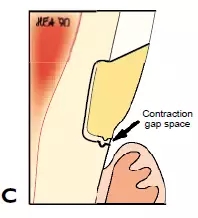 640.webp (5).jpg 640.webp (5).jpg