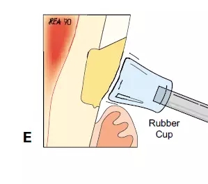 640.webp (10).jpg 640.webp (10).jpg