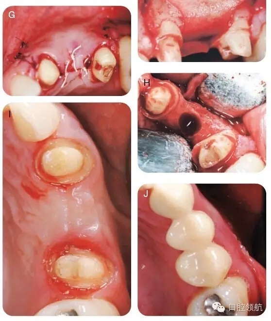 8.webp.jpg 8.webp.jpg