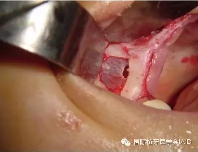 2.webp.jpg 2.webp.jpg