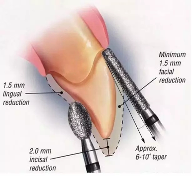 1.webp.jpg 1.webp.jpg