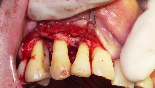 640.webp (4).jpg 640.webp (4).jpg