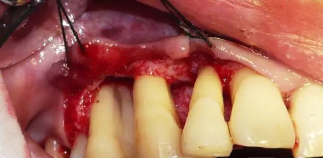 640.webp (5).jpg 640.webp (5).jpg