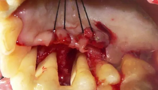 640.webp (6).jpg 640.webp (6).jpg