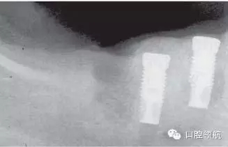 640.webp (2).jpg 640.webp (2).jpg