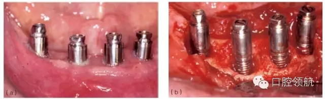 640.webp (3).jpg 640.webp (3).jpg