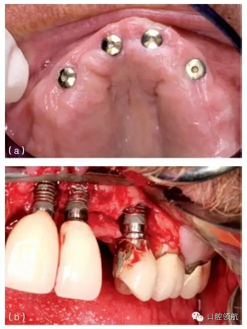 640.webp (4).jpg 640.webp (4).jpg