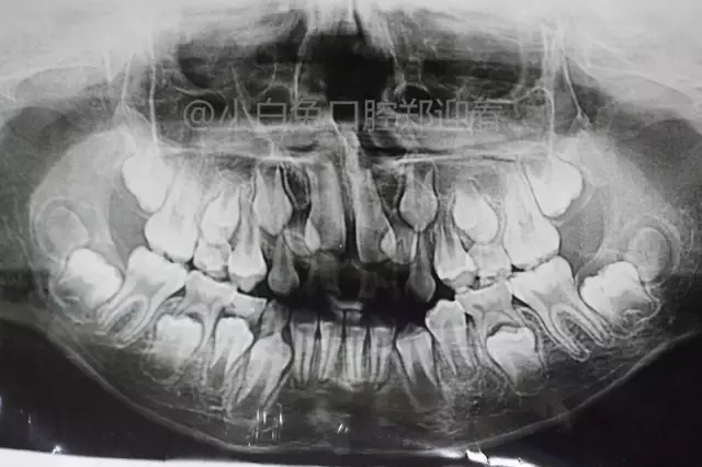 3.webp.jpg 3.webp.jpg