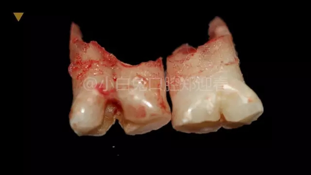 5.webp.jpg 5.webp.jpg