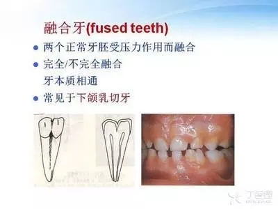 8.webp.jpg 8.webp.jpg