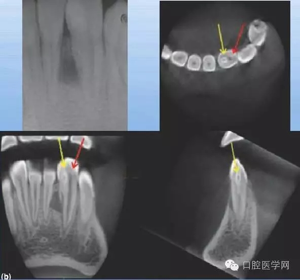 2.webp.jpg 2.webp.jpg