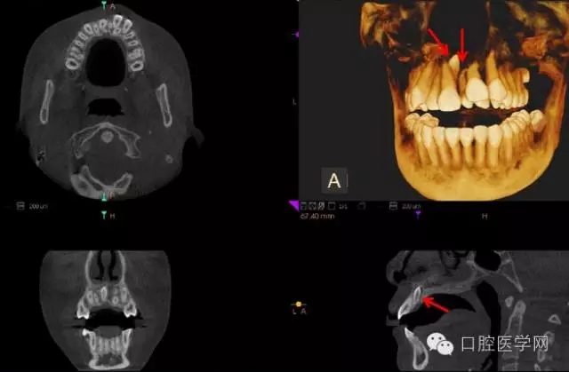 6.webp.jpg 6.webp.jpg
