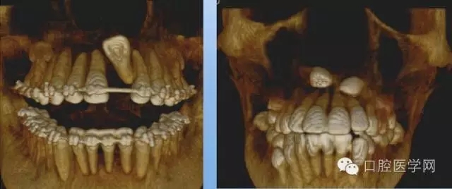 11.webp.jpg 11.webp.jpg