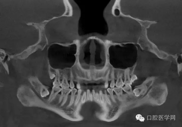 14.webp.jpg 14.webp.jpg