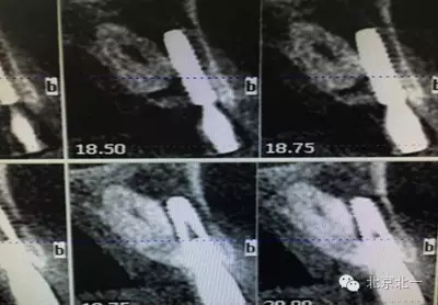 640.webp (1).jpg 640.webp (1).jpg