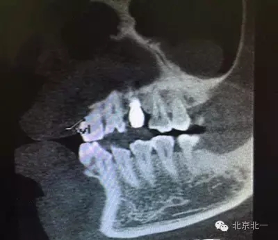 640.webp (3).jpg 640.webp (3).jpg