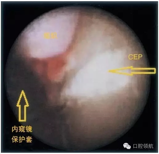 5.webp.jpg 5.webp.jpg