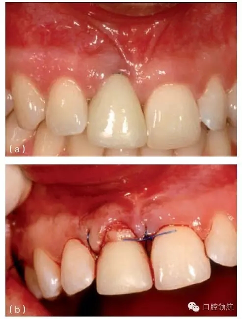 2.webp.jpg 2.webp.jpg