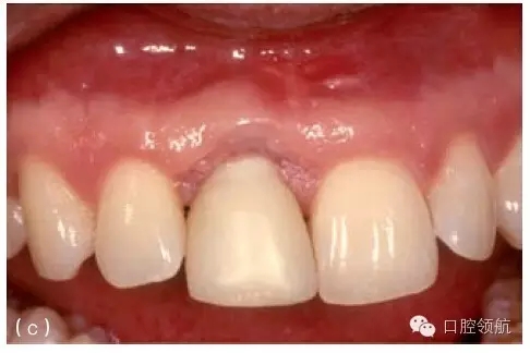 3.webp.jpg 3.webp.jpg