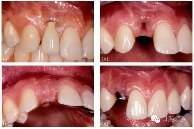 4.webp.jpg 4.webp.jpg