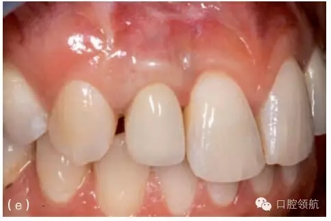 5.webp.jpg 5.webp.jpg