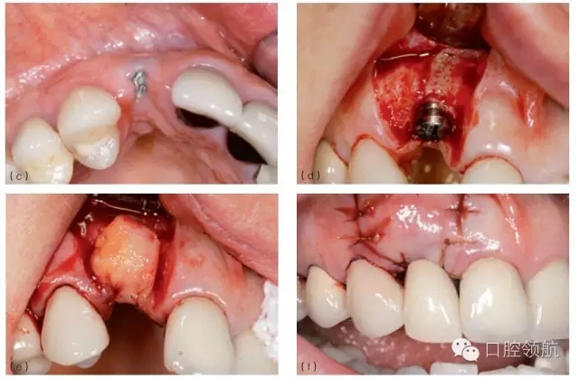 7.webp.jpg 7.webp.jpg