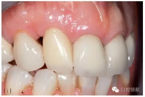 8.webp.jpg 8.webp.jpg