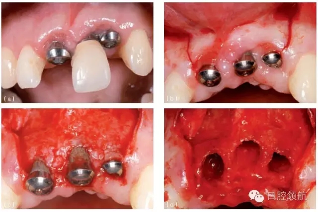 9.webp.jpg 9.webp.jpg