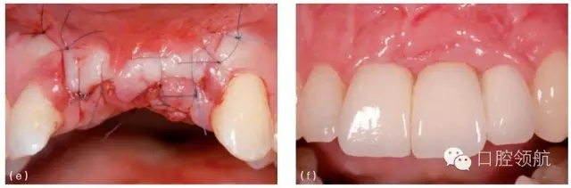 10.webp.jpg 10.webp.jpg