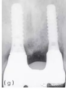 102.webp.jpg 102.webp.jpg