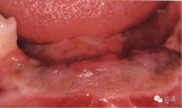 3.webp.jpg 3.webp.jpg