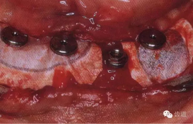 5.webp.jpg 5.webp.jpg