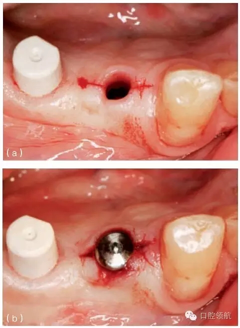 6.webp.jpg 6.webp.jpg