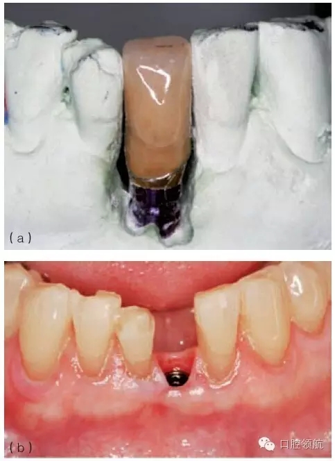 9.webp.jpg 9.webp.jpg