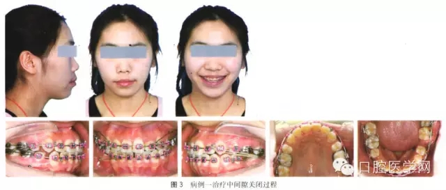 8.webp.jpg 8.webp.jpg